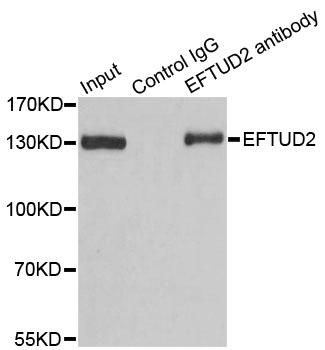 EFTUD2 Antibody - Immunoprecipitation analysis of 100ug extracts of 293T cells.