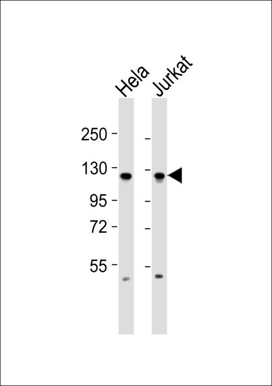 EFTUD2 Antibody - All lanes : Anti-SNRP116 Antibody at 1:1000 dilution Lane 1: HeLa whole cell lysates Lane 2: Jurkat whole cell lysates Lysates/proteins at 20 ug per lane. Secondary Goat Anti-Rabbit IgG, (H+L),Peroxidase conjugated at 1/10000 dilution Predicted band size : 109 kDa Blocking/Dilution buffer: 5% NFDM/TBST.