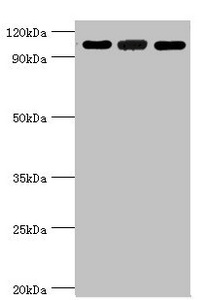 EFTUD2 Antibody - Western blot All Lanes:116 kDaU5 small nuclear ribonucleoprotein component antibody at 3ug/ml Lane 1:Hela whole cell lysate Lane 2:293T whole cell lysate Lane 3:NIH3T3 whole cell lysate Secondary Goat polyclonal to rabbit at 1/10000 dilution Predicted band size: 47,44,37 kDa Observed band size: 109 kDa
