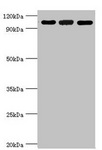 EFTUD2 Antibody - Western blot All Lanes:116 kDaU5 small nuclear ribonucleoprotein component antibody at 3ug/ml Lane 1:Hela whole cell lysate Lane 2:293T whole cell lysate Lane 3:NIH3T3 whole cell lysate Secondary Goat polyclonal to rabbit at 1/10000 dilution Predicted band size: 47,44,37 kDa Observed band size: 109 kDa