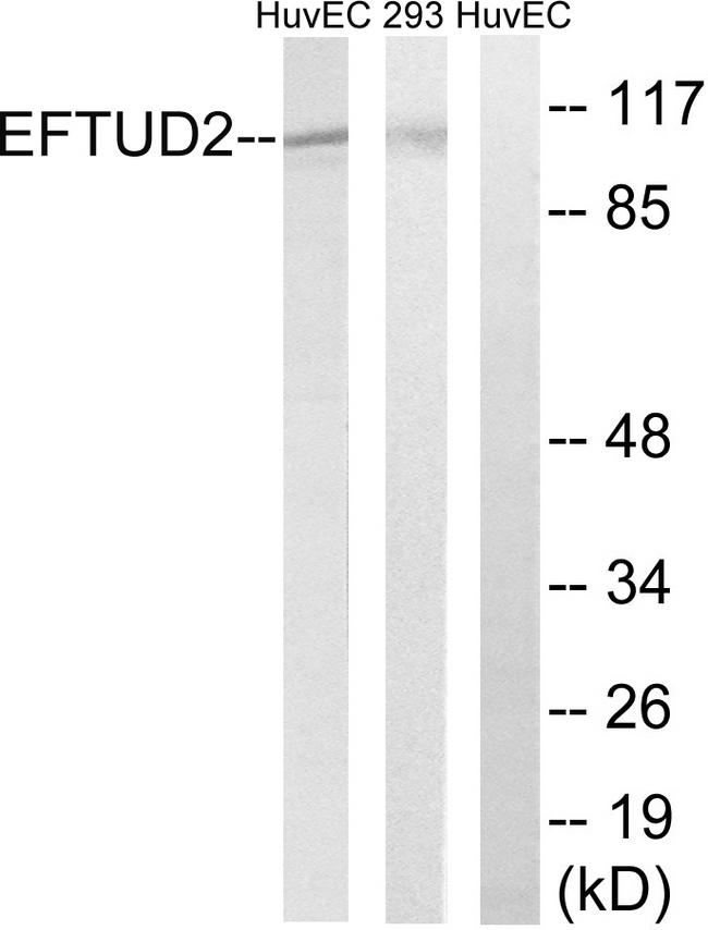 EFTUD2 Antibody - Western blot analysis of extracts from 293 cells and HUVEC cells, using EFTUD2 antibody.