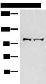 EFTUD2 Antibody - Western blot analysis of Mouse brain tissue and Jurkat cell lysates  using EFTUD2 Polyclonal Antibody at dilution of 1:550