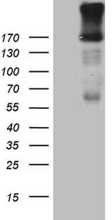 EGF Antibody - HEK293T cells were transfected with the pCMV6-ENTRY control. (Left lane) or pCMV6-ENTRY EGF. (Right lane) cDNA for 48 hrs and lysed. Equivalent amounts of cell lysates. (5 ug per lane) were separated by SDS-PAGE and immunoblotted with anti-EGF. (1:500)