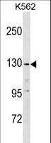 EGF Antibody - EGF Antibody western blot of K562 cell line lysates (35 ug/lane). The EGF antibody detected the EGF protein (arrow).