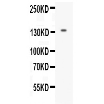 EGF Antibody - Western blot analysis of EGF expression in mouse kidney extract (lane 1). EGF at 134 kD was detected using rabbit anti- EGF Antigen Affinity purified polyclonal antibody at 0.5 ug/mL. The blot was developed using chemiluminescence (ECL) method.