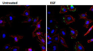 EGF Antibody - IF using EGF Antibody (1H11)