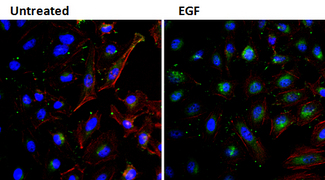 EGF Antibody - IF using EGF Antibody, Biotin, Biotin conjugate (3A8) This image was taken for the unconjugated form of this product. Other forms have not been tested.