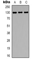 EGF Antibody - Western blot analysis of EGF expression in MCF7 (A); human platelet (B); NIH3T3 (C) whole cell lysates.