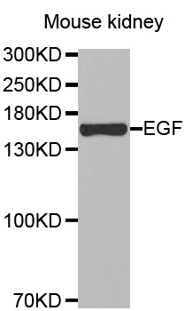 EGF Antibody - Western blot analysis of extracts of Mouse kidney tissue, using EGF antibody.