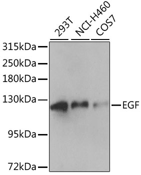 EGF Antibody - Western blot analysis of extracts of various cell lines, using EGF antibody at 1:1000 dilution. The secondary antibody used was an HRP Goat Anti-Rabbit IgG (H+L) at 1:10000 dilution. Lysates were loaded 25ug per lane and 3% nonfat dry milk in TBST was used for blocking. An ECL Kit was used for detection and the exposure time was 90s.
