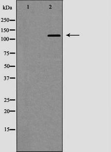 EGF Antibody - Western blot analysis of EGF expression in NIH-3T3 cells. The lane on the left is treated with the antigen-specific peptide.
