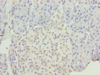 EGFL6 Antibody - Immunohistochemistry of paraffin-embedded human pancreatic tissue using EGFL6 Antibody at dilution of 1:100