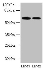 EGFL6 Antibody - Western blot All lanes: EGFL6 antibody at 6µg/ml Lane 1: K562 whole cell lysate Lane 2: Jurkat whole cell lysate Secondary Goat polyclonal to rabbit IgG at 1/10000 dilution Predicted band size: 61 kDa Observed band size: 61 kDa