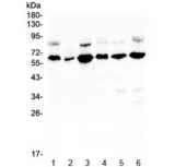 EGFL6 Antibody - Western blot testing of human 1) U-87 MG, 2) A431, 3) HL-60, 4) K562, 5) ThP-1 and 6) HeLa lysate with EGFL6 antibody at 0.5ug/ml. Predicted molecular weight ~62 kDa.