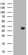 EGFL7 Antibody - HEK293T cells were transfected with the pCMV6-ENTRY control. (Left lane) or pCMV6-ENTRY EGFL7. (Right lane) cDNA for 48 hrs and lysed. Equivalent amounts of cell lysates. (5 ug per lane) were separated by SDS-PAGE and immunoblotted with anti-EGFL7. (1:2000)