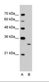 EGFL8 / NG3 Antibody - A: Marker, B: Jurkat Cell Lysate.  This image was taken for the unconjugated form of this product. Other forms have not been tested.