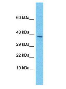EGFLAM Antibody - EGFLAM antibody Western Blot of Uterus Tumor. Antibody dilution: 1 ug/ml.  This image was taken for the unconjugated form of this product. Other forms have not been tested.