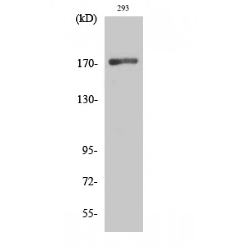 EGFR Antibody - Western blot of EGFR antibody