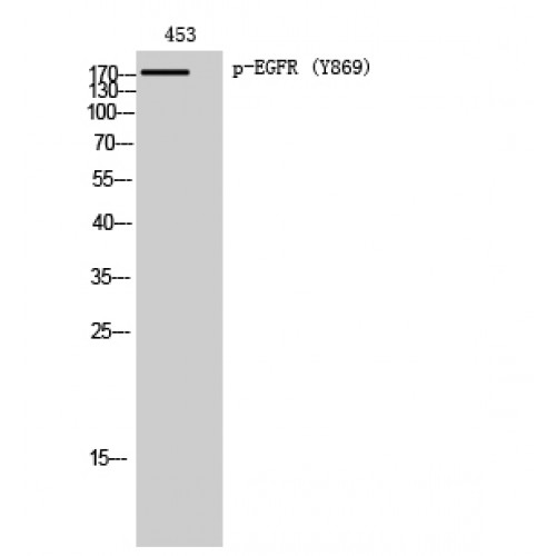 EGFR Antibody - Western blot of Phospho-EGFR (Y869) antibody