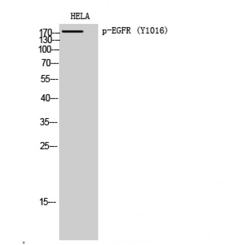 EGFR Antibody - Western blot of Phospho-EGFR (Y1016) antibody