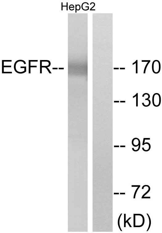 EGFR Antibody - Western blot analysis of lysates from A431 cells, treated with EGF 200ng/ml 10', using EGFR Antibody. The lane on the right is blocked with the synthesized peptide.
