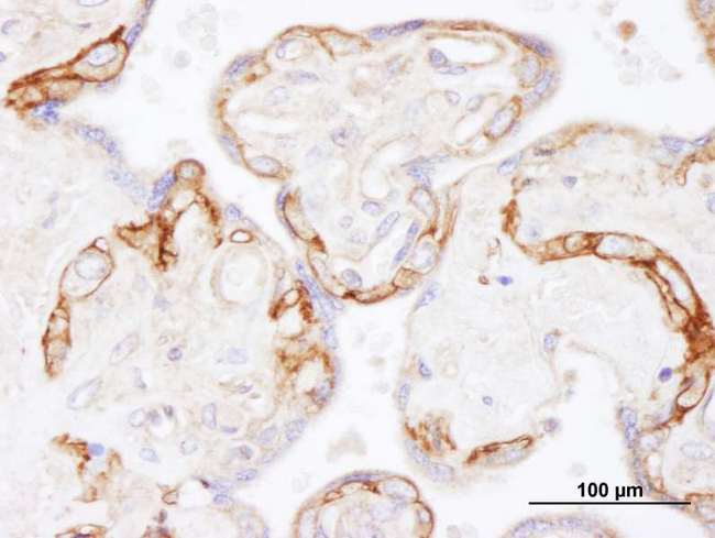 EGFR Antibody - Detection of Human EGFR by Immunohistochemistry. Sample: FFPE section of human placenta. Antibody: Affinity purified rabbit anti-EGFR used at a dilution of 1:1000 (1 Detection: DAB.