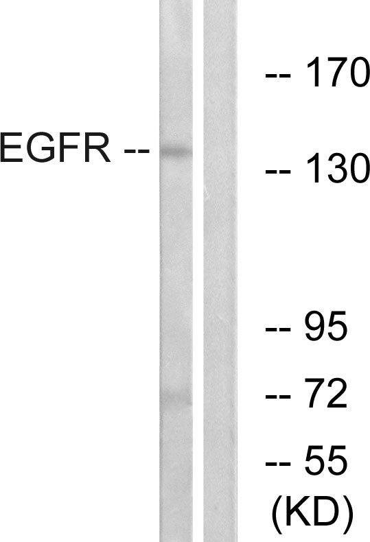 EGFR Antibody - Western blot analysis of lysates from A431 cells, treated with EGF 40Î¼M 10', using EGFR Antibody. The lane on the right is blocked with the synthesized peptide.
