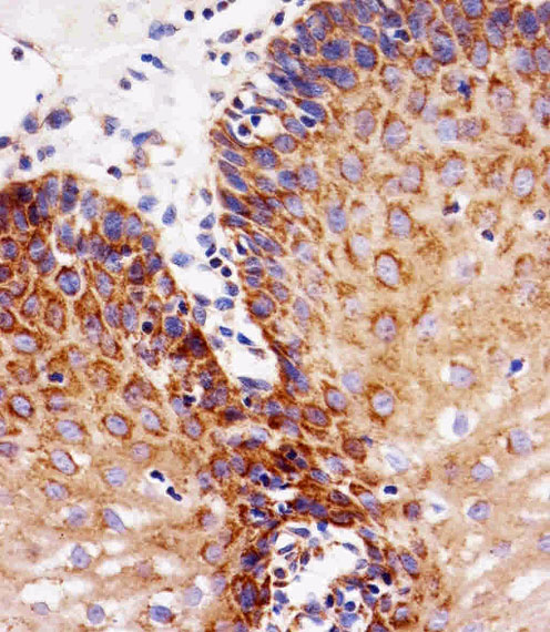 EGFR Antibody - Immunohistochemical of paraffin-embedded H. esophagus section using EGFR Antibody. Antibody was diluted at 1:25 dilution. A peroxidase-conjugated goat anti-rabbit IgG at 1:400 dilution was used as the secondary antibody, followed by DAB staining.