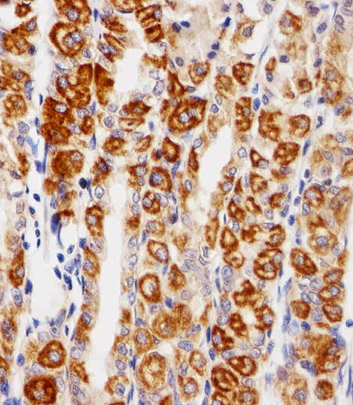 EGFR Antibody - Immunohistochemical of paraffin-embedded H. stomach section using EGFR Antibody. Antibody was diluted at 1:25 dilution. A peroxidase-conjugated goat anti-rabbit IgG at 1:400 dilution was used as the secondary antibody, followed by DAB staining.