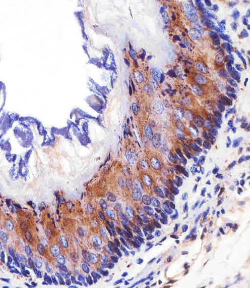 EGFR Antibody - Immunohistochemical of paraffin-embedded M. esophagus section using EGFR Antibody. Antibody was diluted at 1:25 dilution. A peroxidase-conjugated goat anti-rabbit IgG at 1:400 dilution was used as the secondary antibody, followed by DAB staining.