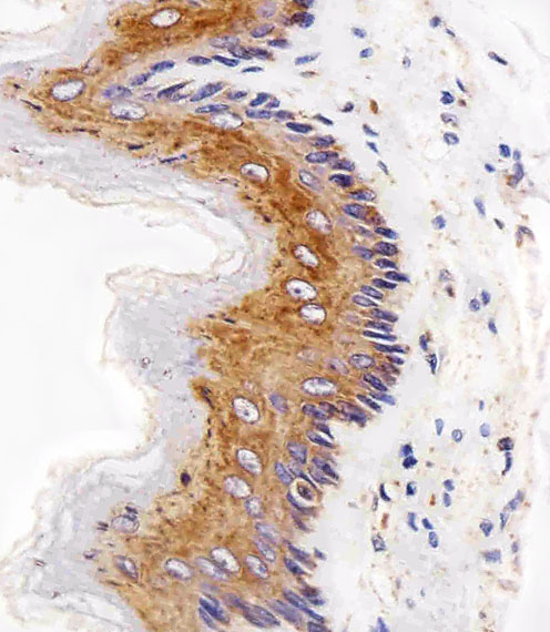 EGFR Antibody - Immunohistochemical of paraffin-embedded R. esophagus section using EGFR Antibody. Antibody was diluted at 1:25 dilution. A peroxidase-conjugated goat anti-rabbit IgG at 1:400 dilution was used as the secondary antibody, followed by DAB staining.