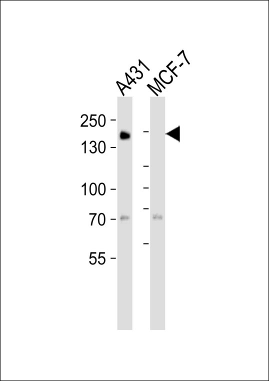EGFR Antibody - Western blot of lysates from A431, MCF-7 cell line (from left to right), using EGFR Antibody. Antibody was diluted at 1:1000 at each lane. A goat anti-mouse IgG H&L (HRP) at 1:3000 dilution was used as the secondary antibody. Lysates at 35ug per lane.