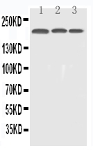 EGFR Antibody - Western blot - Anti-EGFR Picoband Antibody