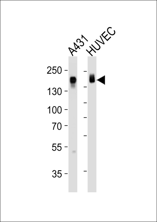 EGFR Antibody - Western blot of lysates from A431, HUVEC cell line (from left to right), using EGFR Antibody. Antibody was diluted at 1:1000 at each lane. A goat anti-rabbit IgG H&L (HRP) at 1:5000 dilution was used as the secondary antibody. Lysates at 35ug per lane.