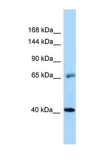 EGFR Antibody - EGFR antibody Western blot of Placenta lysate. Antibody concentration 1 ug/ml.  This image was taken for the unconjugated form of this product. Other forms have not been tested.
