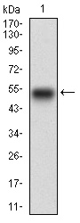 EGFR Antibody - Western blot using EGFR monoclonal antibody against human EGFR recombinant protein. (Expected MW is 48.2 kDa)