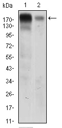 EGFR Antibody - Western blot using EGFR mouse monoclonal antibody against A431 (1) AND HeLa (2) cell lysate.