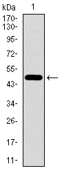 EGFR Antibody - Western blot using EGFR mutant monoclonal antibody against human EGFR mutant recombinant protein. (Expected MW is 36.9 kDa)