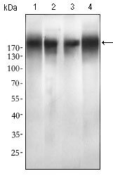 EGFR Antibody - Western blot using EGFR mutant mouse monoclonal antibody against SPC-A-1 (1), A549 (2), HepG2 (3) and MCF-7 (4) cell lysate.