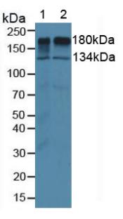 EGFR Antibody - Western Blot; Sample: Lane1: Human Serum; Lane2: Human A549 Cells.