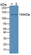 EGFR Antibody - Western Blot; Sample: Lane1: Human Liver Tissue; Lane2: Human Hela Cells.