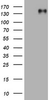 EGFR Antibody - HEK293T cells were transfected with the pCMV6-ENTRY control (Left lane) or pCMV6-ENTRY EGFR (Right lane) cDNA for 48 hrs and lysed. Equivalent amounts of cell lysates (5 ug per lane) were separated by SDS-PAGE and immunoblotted with anti-EGFR.