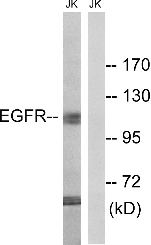 EGFR Antibody - Western blot analysis of lysates from Jurkat cells, treated with UV 15', using EGFR Antibody. The lane on the right is blocked with the synthesized peptide.