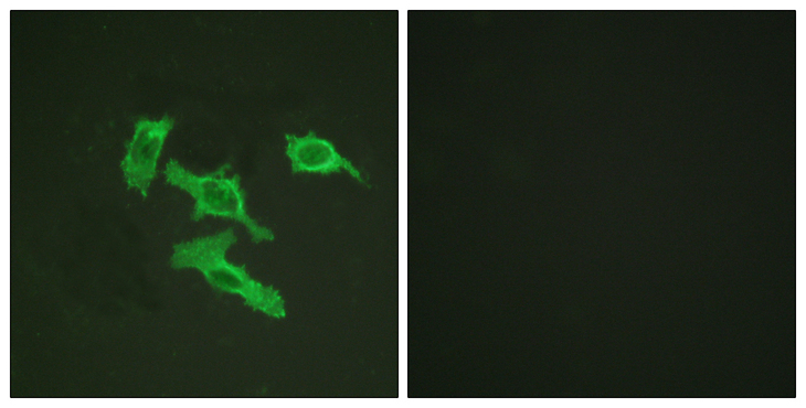 EGFR Antibody - Immunofluorescence analysis of HepG2 cells, using EGFR Antibody. The picture on the right is blocked with the synthesized peptide.