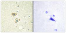 EGFR Antibody - Immunohistochemistry analysis of paraffin-embedded human brain tissue, using EGFR Antibody. The picture on the right is blocked with the synthesized peptide.