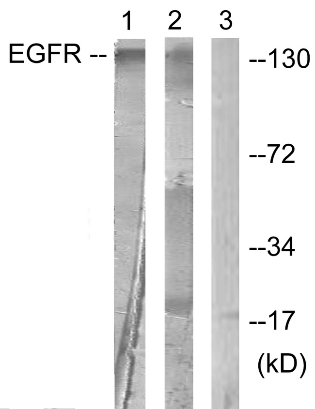 EGFR Antibody - Western blot analysis of lysates from HUVEC cells, treated with Serum 20% 30', using EGFR Antibody. The lane on the right is blocked with the synthesized peptide.