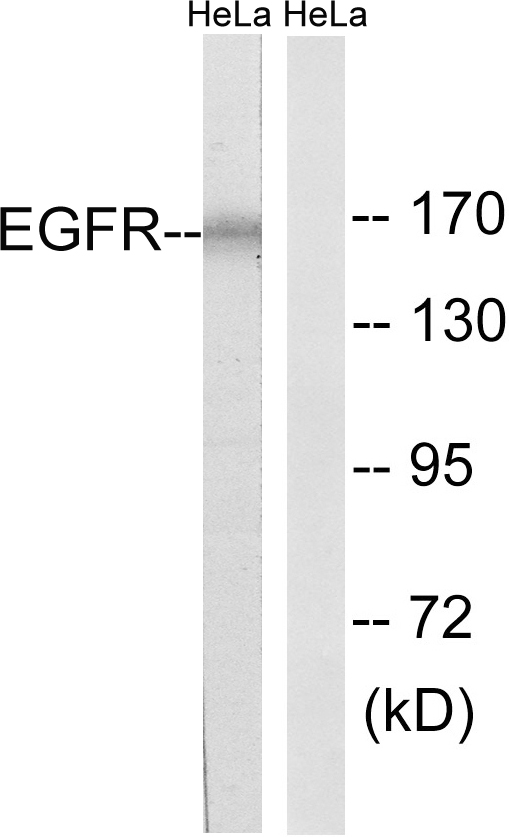 EGFR Antibody - Western blot analysis of lysates from HeLa cells, using EGFR Antibody. The lane on the right is blocked with the synthesized peptide.