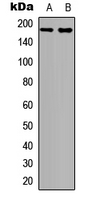 EGFR Antibody - Western blot analysis of EGFR (pY1092) expression in HepG2 UV-treated (A); A431 UV-treated (B) whole cell lysates.