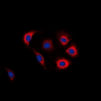 EGFR Antibody - Immunofluorescent analysis of EGFR (pY1016) staining in Jurkat cells. Formalin-fixed cells were permeabilized with 0.1% Triton X-100 in TBS for 5-10 minutes and blocked with 3% BSA-PBS for 30 minutes at room temperature. Cells were probed with the primary antibody in 3% BSA-PBS and incubated overnight at 4 deg C in a humidified chamber. Cells were washed with PBST and incubated with a DyLight 594-conjugated secondary antibody (red) in PBS at room temperature in the dark. DAPI was used to stain the cell nuclei (blue).