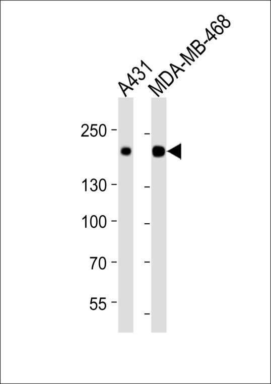 EGFR Antibody - Western blot of lysates from A431, MDA-MB-468 cell line (from left to right), using EGFR Antibody. Antibody was diluted at 1:1000 at each lane. A goat anti-rabbit IgG H&L (HRP) at 1:10000 dilution was used as the secondary antibody. Lysates at 20ug per lane.